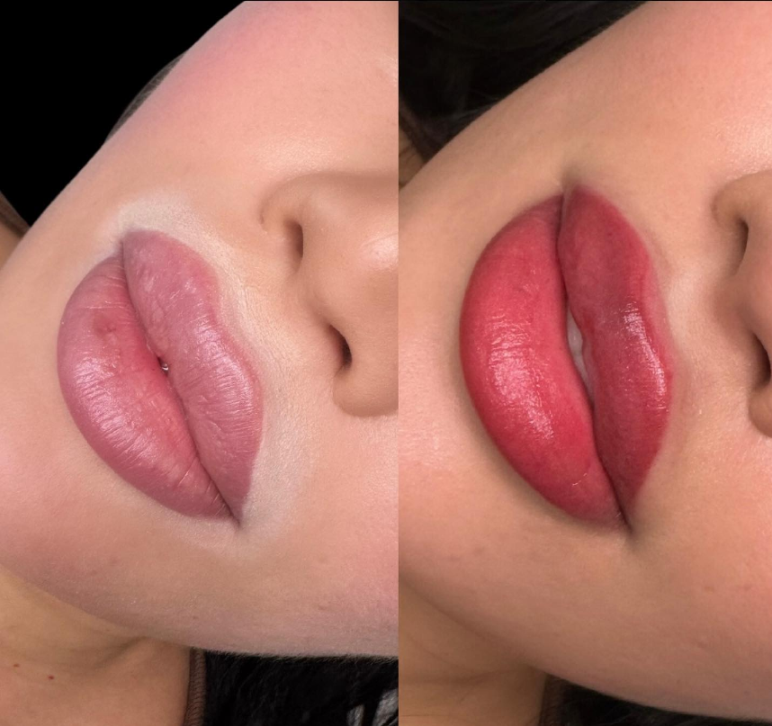 Zeiva Professional Center - Old color red Lip tattoo removal !! Amazing  results after only one treatment #tattoo #redcolortattoo  #lasertattooremoval #lasertattooremoval #tattooink #allcolors  #allcolortattooremoval #zeivaprofessionalcenter call zeiva ...